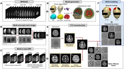 Estimation of brain tissue response by electrical stimulation in a subject-specific model implemented by conductivity tensor imaging